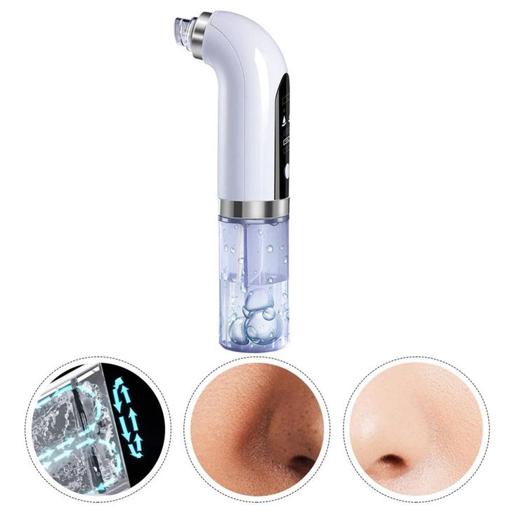 Electric Blackhead Acne Oil Remover