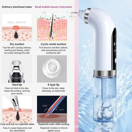 Electric Blackhead Acne Oil Remover